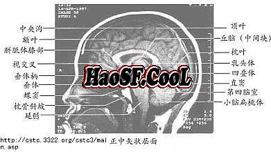 征战传奇1.76复古